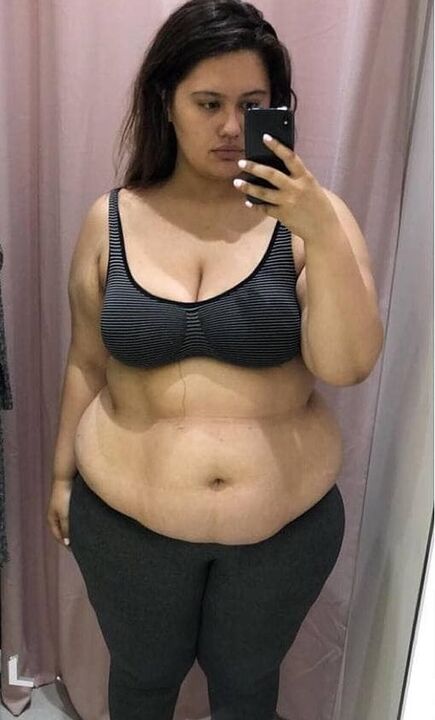 Я ненавідзела сваё цела з-за лішніх кілаграмаў.